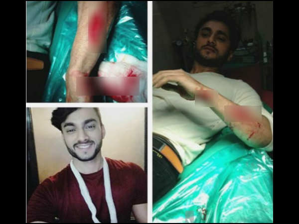 naagin-2-actor-aryan-pandit-meets-with-a-serious-accident-on-set-gets-18-stitches