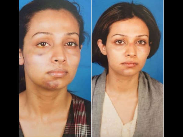 actress-flora-saini-accused-her-ex-boyfriend-producer-gaurang-doshi