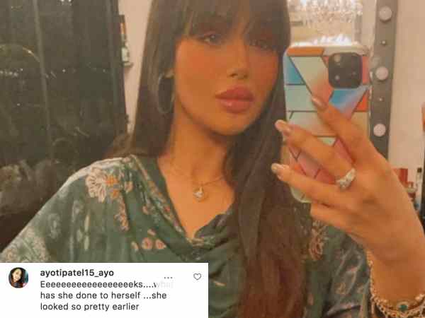ayesha-takia-s-lip-surgery-is-horrible-comment-fans-bollywood-actresses-who-had-lip-surgery ayesha-takia-s-lip-surgery-is-horrible-comment-fans-bollywood-actresses-who-had-lip-surgery