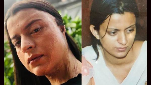 delhi-acid-attack-kangana-ranaut-recalls-acid-attack-on-sister-rangoli-share-the-horrific-experience