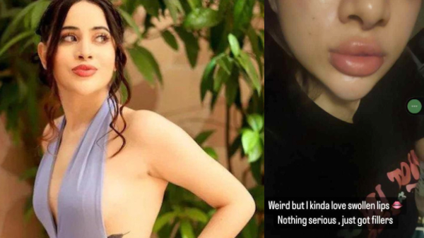 urfi-javed-lips-swollen-shares-weird-picture-of-her-changed-face-says-its-not-serious