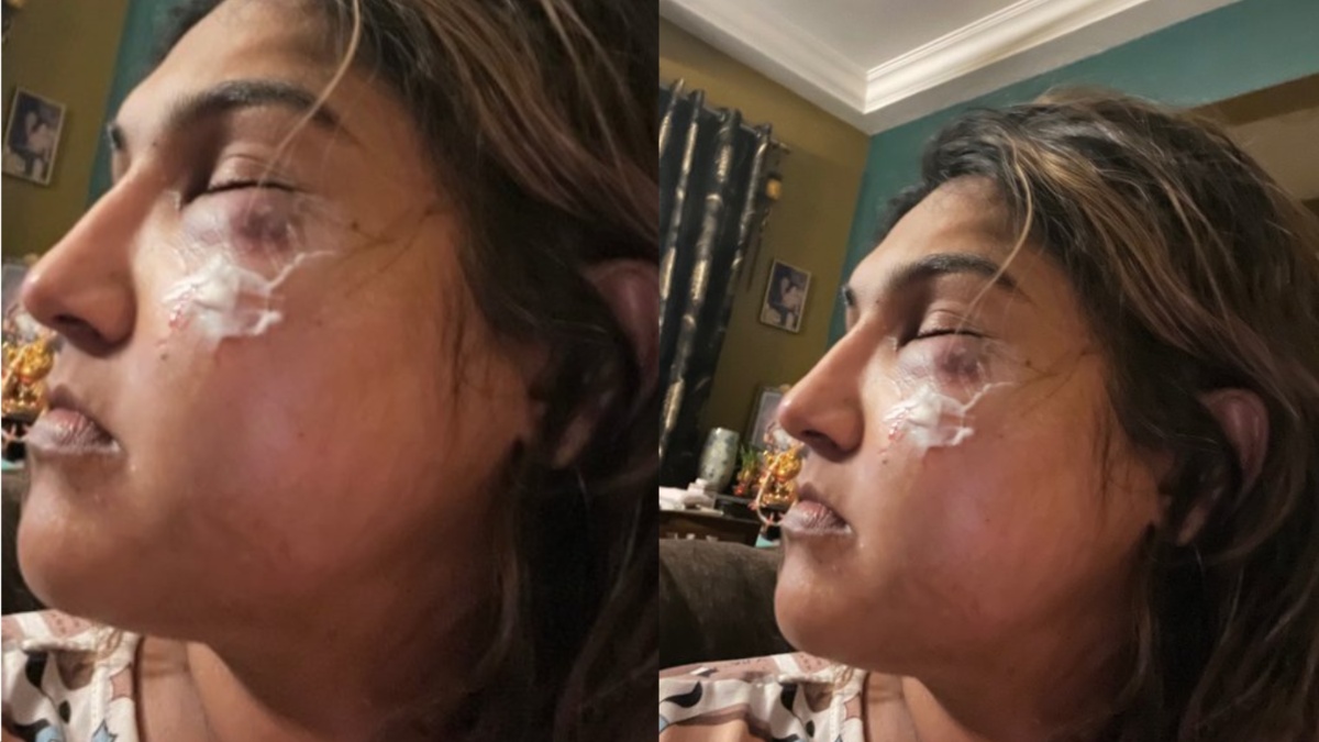 देर रात ये एक्ट्रेस गई थी गाड़ी पार्क करने, तभी एक शख्स ने आकर किया ऐसा जोरदार हमला पहचान में नहीं आ रही शक्ल
