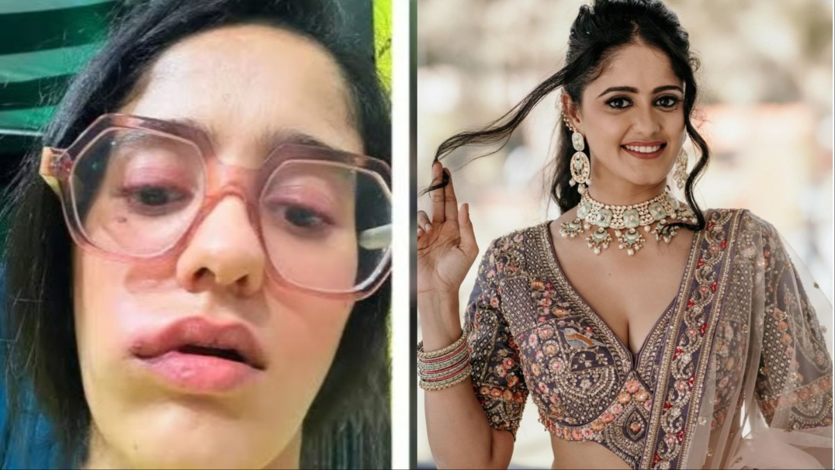 सूजता जा रहा है Ayesha Singh का चेहरा