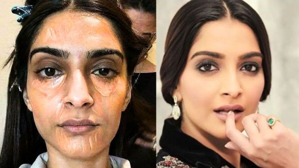 dark circles problem