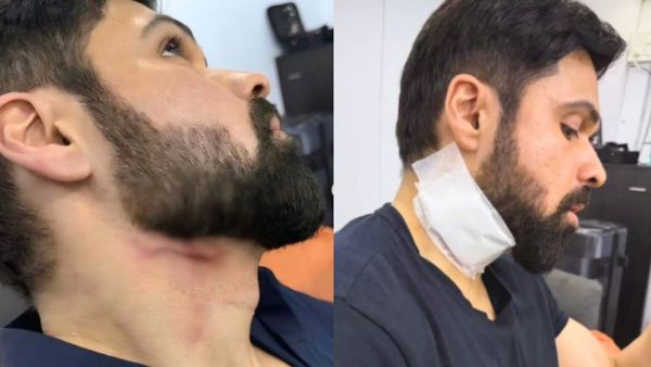 Emraan Hashmi Injured