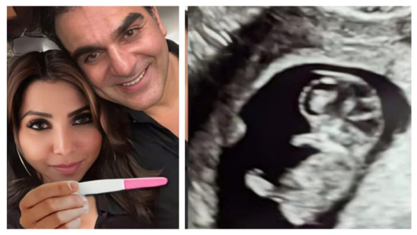 Arbaaz Khan Shura Khan Pregnancy Announcement