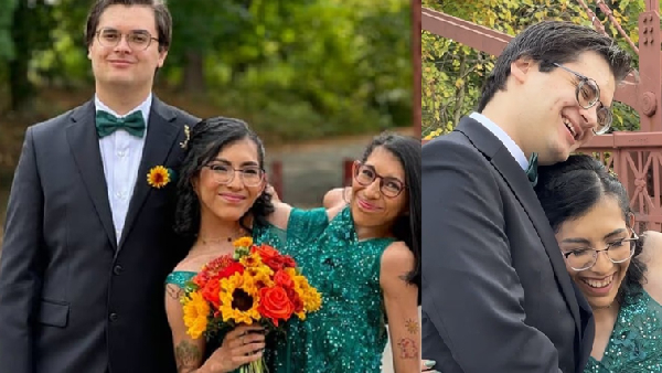 Conjoined twin Carmen Andrade