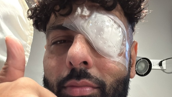 Badshah Eye Injury Badshah Eye Injury