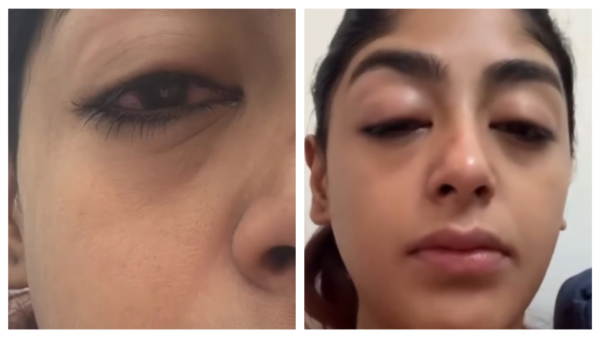 Preet Singh Physical Assault Preet Singh Physical Assault