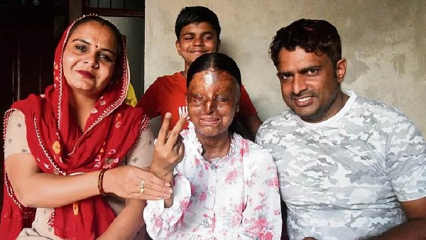 Acid Attack Survivor Success Story