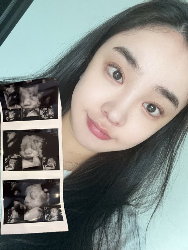 Na Hyun Pregnant Before Marraige Na Hyun Pregnant Before Marraige