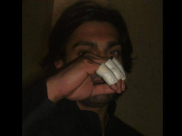 Karan's Hurt Fingers