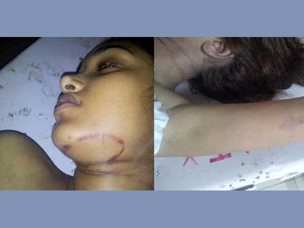 Breath Snatched Away 