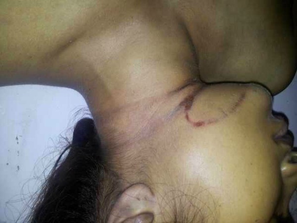 Police Hiding Facts?