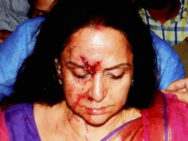 Injured Hema Injured Hema