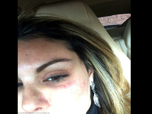  Chris Brown Accused Of Punching A Woman In The Face: Singer Calls It ‘Unequivocally Untrue’