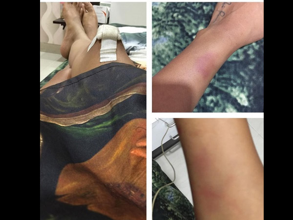 Oops! Jamai Raja’s Roshini Aka Nia Sharma Gets Injured!