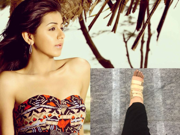 Nikki Galrani Injured Leg Nikki Galrani Injured Leg