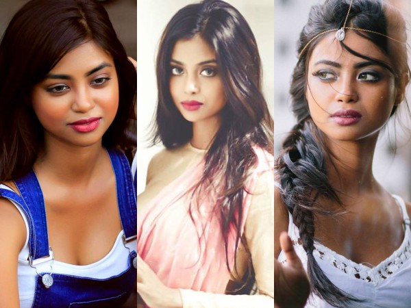 Shaun Romy: I Was Worried About My Complexion