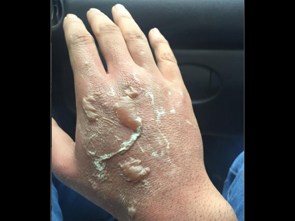 Oops! Kushal Tandon Gets Hurt While Saving His Co-Actress Aneri Vajani!