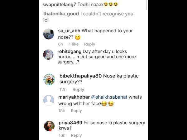 Negative Comments On Priyanka’s Nose