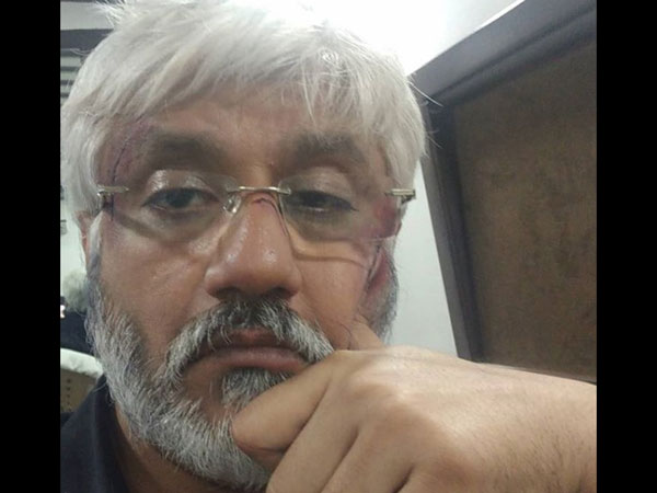 Some Felt His Old Look Was Good!