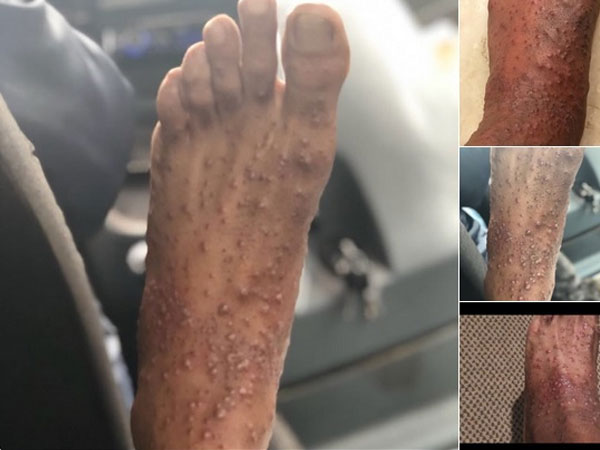 Why Was Sree Missing On Second Day On KKK 9?