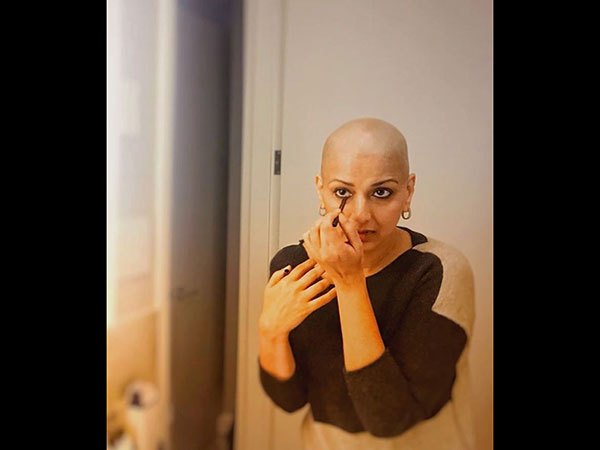 When Sonali Opened Up About How Her Hair Was The Talk Of The Town