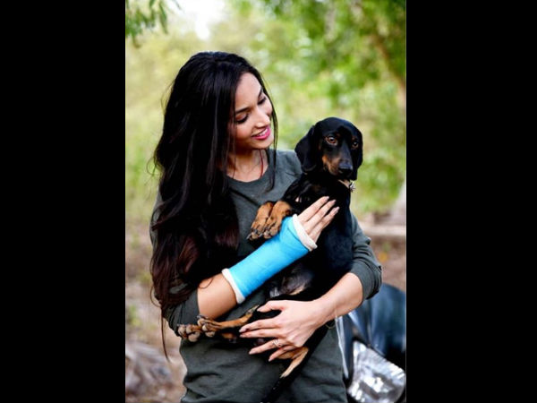 Srinidhi Shetty’s Injured & This Picture Is The PROOF! Srinidhi Shetty’s Injured & This Picture Is The PROOF!