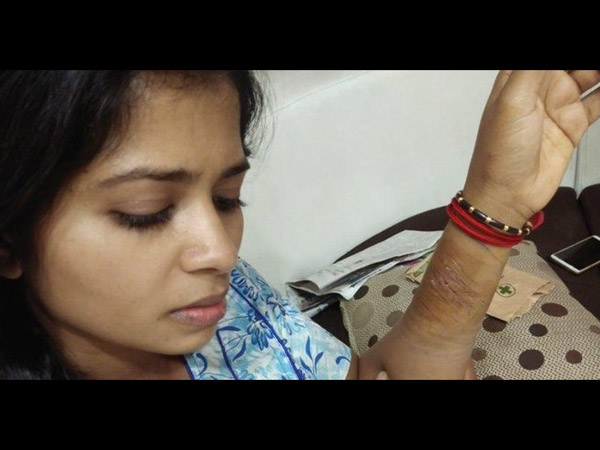 Madhumithas Suicide Attempt At Bigg Boss Tamil 3 House: Pic Goes Viral On Social Media!