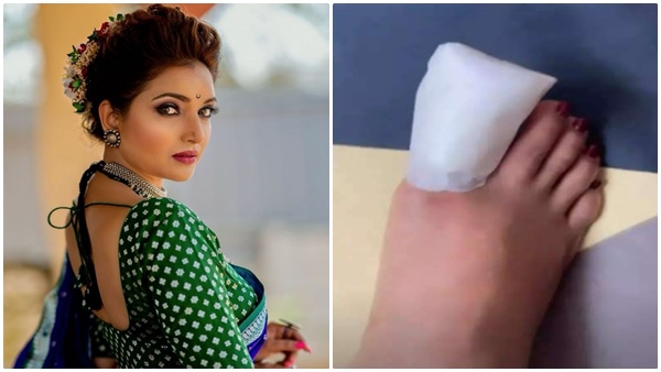 Rupali Bhosle Gets Injured On The Sets Of Aai Kuthe Kaay Karte; Says ‘The Injury Was Too Serious’ Rupali Bhosle Gets Injured On The Sets Of Aai Kuthe Kaay Karte; Says ‘The Injury Was Too Serious’