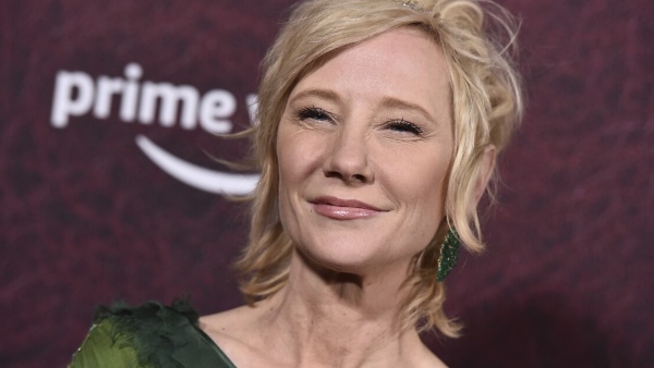 Anne Heche Severely Burned In Car Crash: Celebs Wish Her A Speedy Recovery Anne Heche Severely Burned In Car Crash: Celebs Wish Her A Speedy Recovery