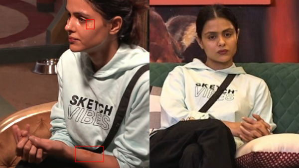 injury priyanka choudhary injury priyanka choudhary