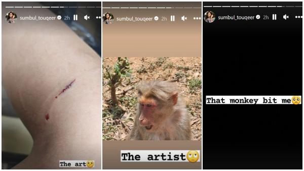 Sumbul Touqeer Khan Bitten By A Monkey During Her Vacation In Ooty