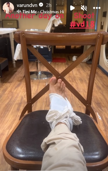 Varun Dhawan Sustains Injury While Filming for VD18 in Kerala
