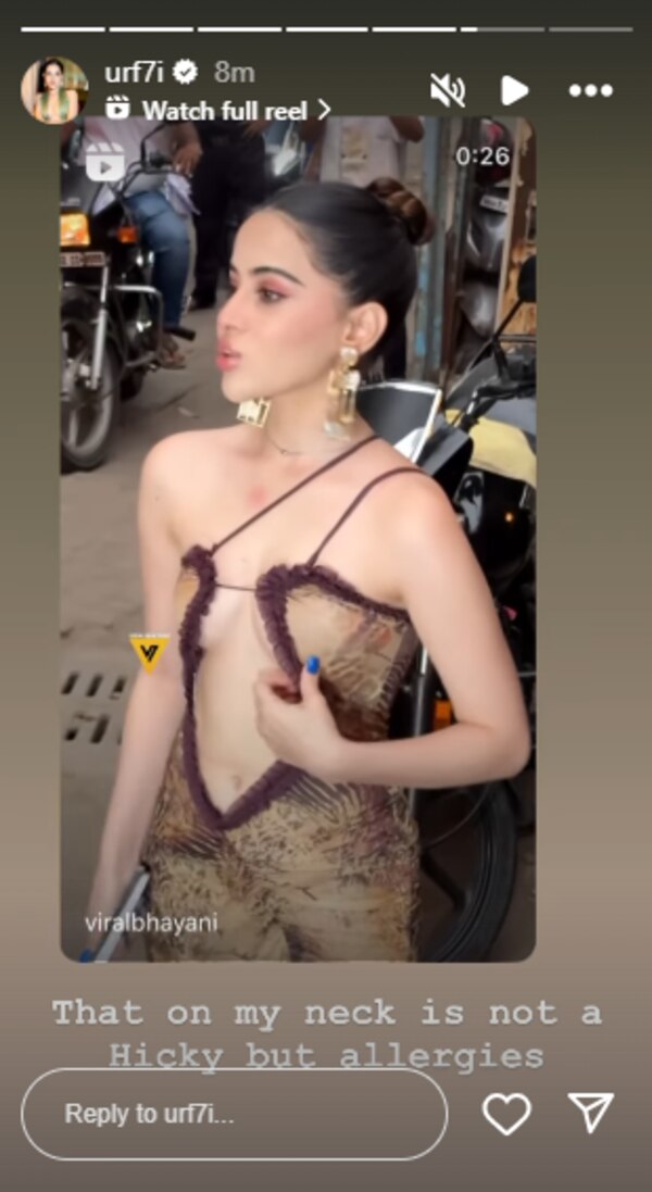 Uorfi Javed Spotted With A Love Bite Uorfi Javed Spotted With A Love Bite