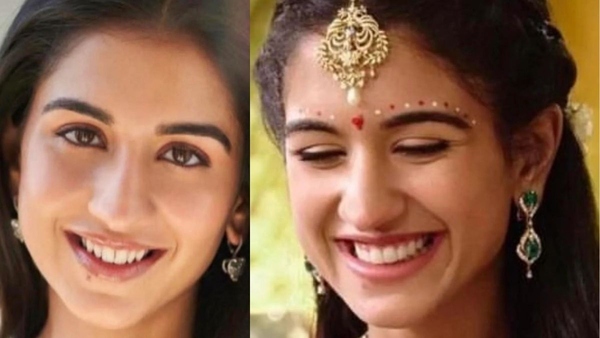 Did Radhika Merchant Get A Dental Makeover For Wedding