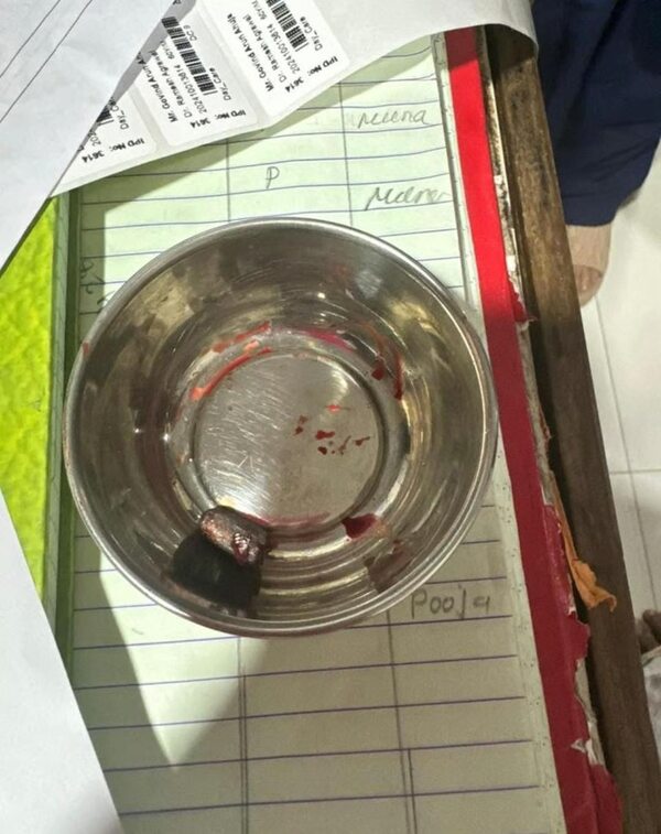 Govinda Health Update PIC Of Bullet Surfaces