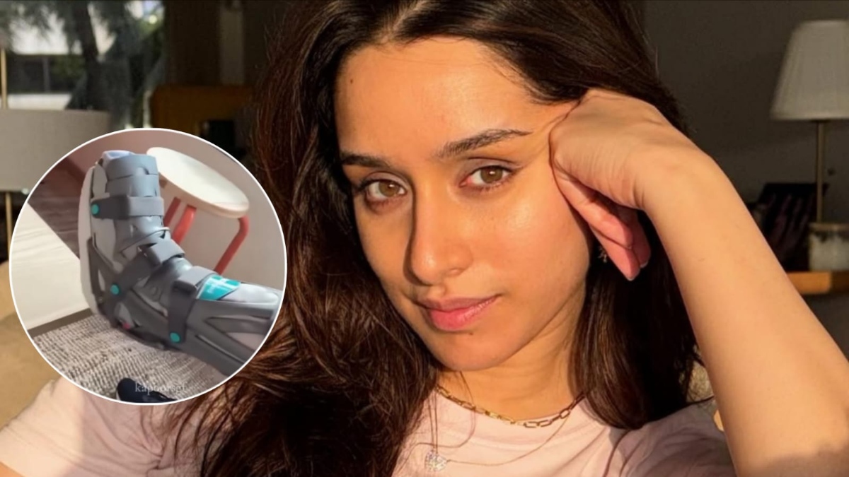 Shraddha Kapoor Leg Injury Update Shraddha Kapoor Leg Injury Update