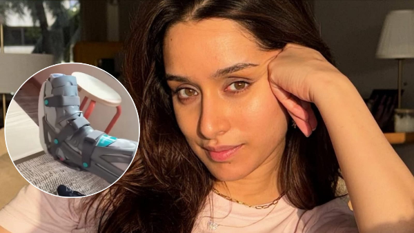 Shraddha Kapoor Leg Injury Update