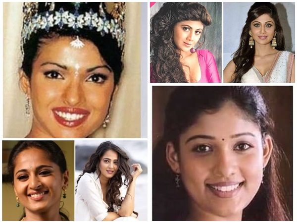 പ്ലാസ്റ്റിക് സർജറി മുതല്‍ കോസ്മെറ്റിക് സർജറി വരെ ; സുന്ദരിയാകാന്‍ ഇന്ത്യന്‍ നടിമാർ സഞ്ചരിച്ച വഴികള്‍