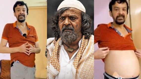 ಹೊಟ್ಟೆಗೆ ಪಸರಿಸಿದ ಕ್ಯಾನ್ಸರ್; ಚಿಂತಾಜನಕ ಸ್ಥಿತಿಯಲ್ಲಿ ನಟ ಹರೀಶ್ ರಾಯ್ 