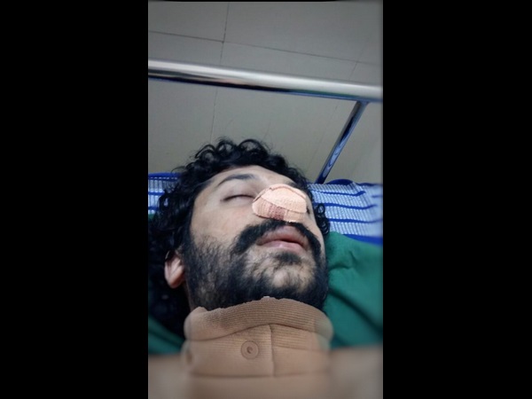 ಚಿತ್ರೀಕರಣದ ವೇಳೆ ಭುವನ್ ಗೆ ಗಾಯ 