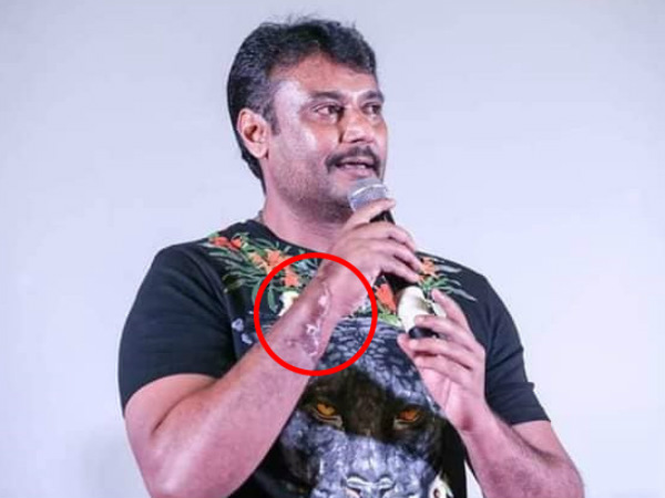 ದರ್ಶನ್ ಅವರದ್ದು 'ಆರದ ಗಾಯ'