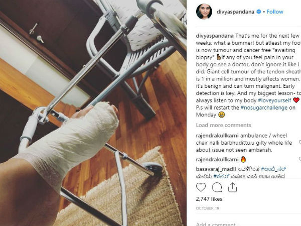 ಅಪರೂಪದ ಕಾಯಿಲೆಯಿಂದ ಬಳಲುತ್ತಿರುವ ರಮ್ಯಾ