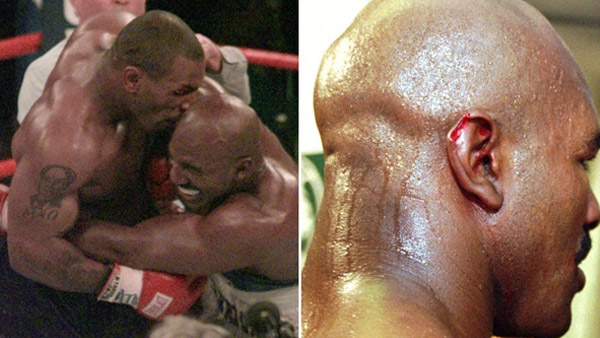 ಕಿವಿ ಕಚ್ಚಿದ್ದ ಮೈಕ್ ಟೈಸನ್