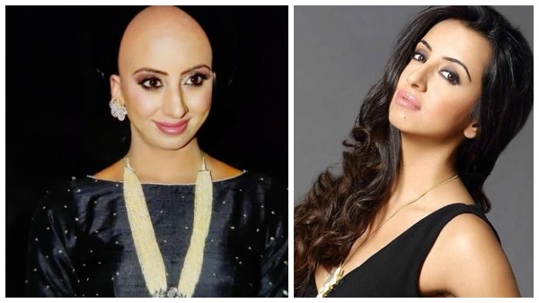 ಸಂಜನಾ ಬೋಳು ತಲೆಯ ಫೋಟೊ ವೈರಲ್!