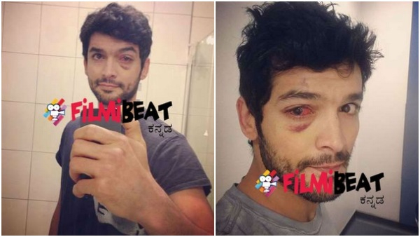 ದಿಗಂತ್ ಬಲಗಣ್ಣು ಅಸ್ಪಷ್ಟ 