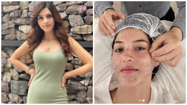 Actress Mehreen Pirzada Took Acu skin lift skin tightening treatment