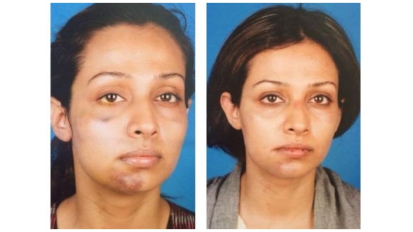  ಅಲ್ಲಿಂದ ಓಡಿ ಬಂದುಬಿಟ್ಟಿದ್ದೆ